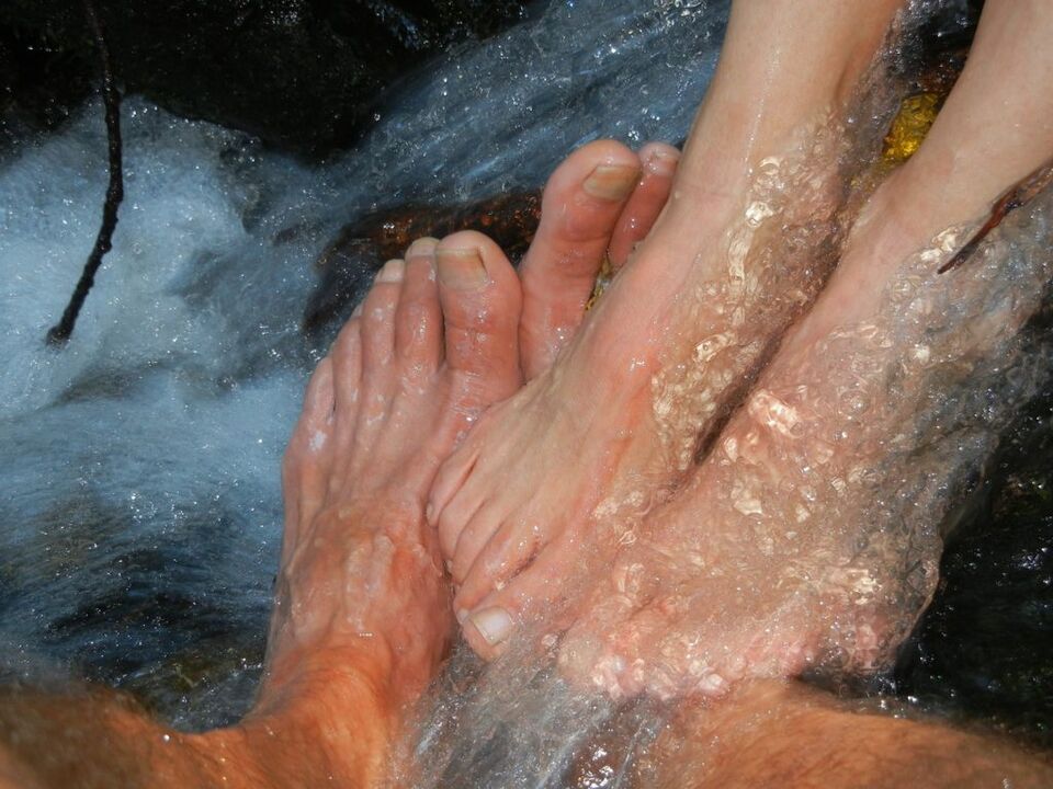 Mycose des ongles de jambe