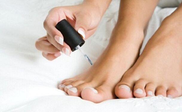 Nail Fungus Cure Vernis